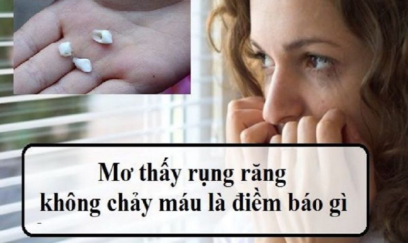 Giải thích ý nghĩa giấc mơ rụng răng nhưng không chảy máu