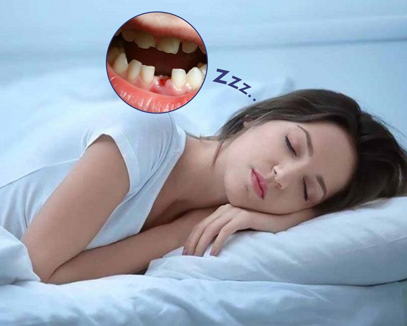 Tại sao lại mơ rụng răng không chảy máu? Cách hóa giải điềm xấu